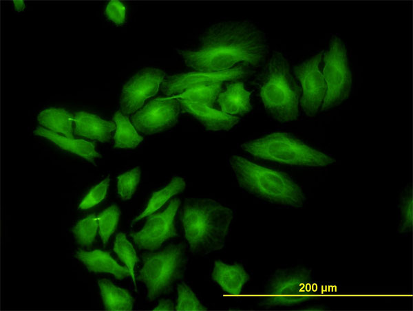 ENO3 / Enolase 3 Antibody - Immunofluorescence of monoclonal antibody to ENO3 on HeLa cell. [antibody concentration 10 ug/ml]