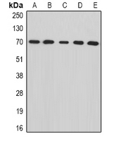 ENOX2 Antibody - Western blot analysis of tNOX expression in SW480 (A); Jurkat (B); mouse kidney (C); mouse ovary (D); rat liver (E) whole cell lysates.