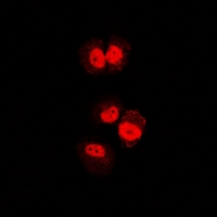 ENOX2 Antibody - Immunofluorescent analysis of tNOX staining in U2OS cells. Formalin-fixed cells were permeabilized with 0.1% Triton X-100 in TBS for 5-10 minutes and blocked with 3% BSA-PBS for 30 minutes at room temperature. Cells were probed with the primary antibody in 3% BSA-PBS and incubated overnight at 4 deg C in a humidified chamber. Cells were washed with PBST and incubated with a DyLight 594-conjugated secondary antibody (red) in PBS at room temperature in the dark.
