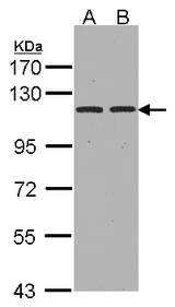 ENPEP / Aminopeptidase A Antibody - Sample(30 ug whole cell lysate). A: Hep G2. B: HeLa S3. 7.5% SDS PAGE. ENPEP antibody diluted at 1:1000.