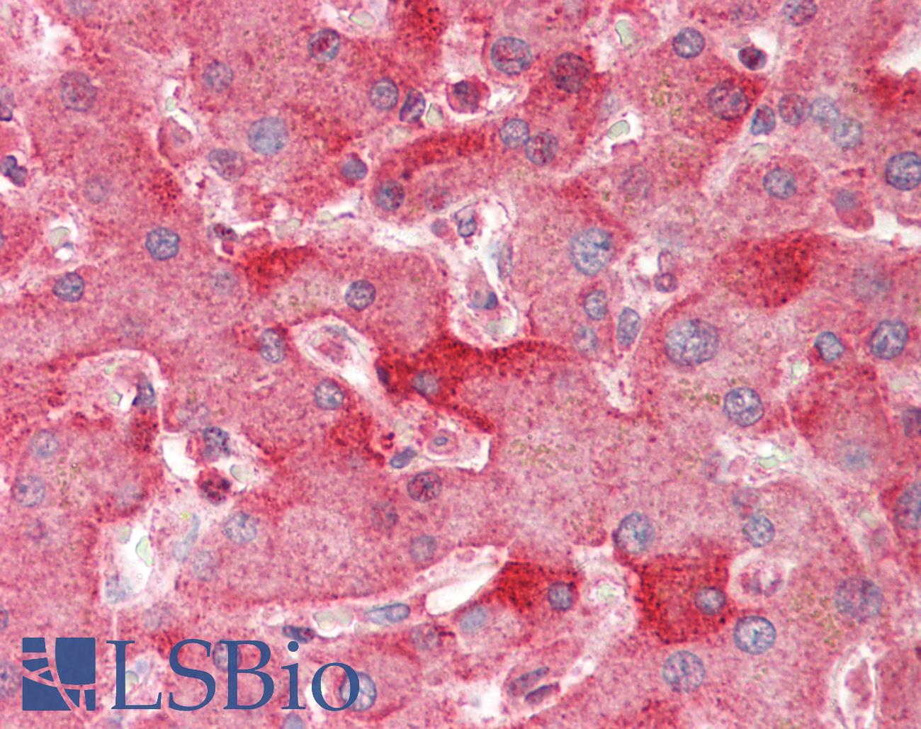 ENPP2 / Autotaxin Antibody - Anti-ENPP2 / Autotaxin antibody IHC staining of human liver. Immunohistochemistry of formalin-fixed, paraffin-embedded tissue after heat-induced antigen retrieval.