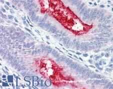 ENPP3 / CD203c Antibody - Anti-ENPP3 antibody IHC of human uterus. Immunohistochemistry of formalin-fixed, paraffin-embedded tissue after heat-induced antigen retrieval.