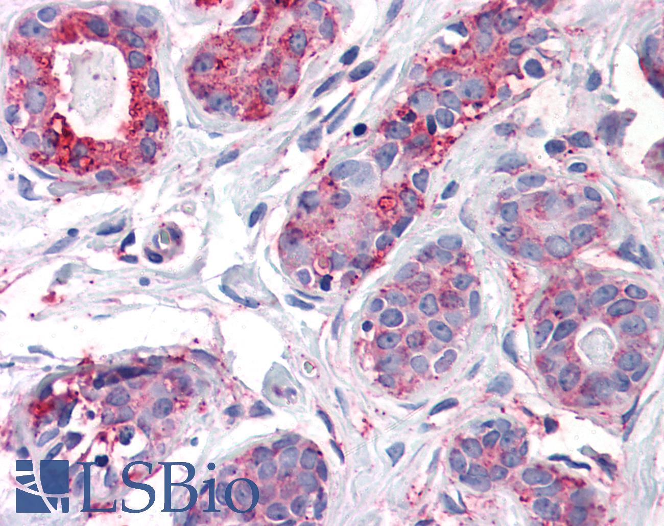 ENTPD2 Antibody - Anti-ENTPD2 antibody IHC of human breast. Immunohistochemistry of formalin-fixed, paraffin-embedded tissue after heat-induced antigen retrieval.