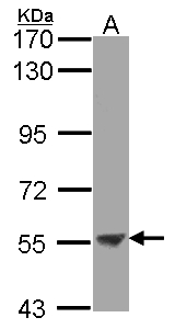 ENTPD3 Antibody - Sample (30 ug of whole cell lysate). A: Molt-4 . 7.5% SDS PAGE. ENTPD3 antibody diluted at 1:2000.