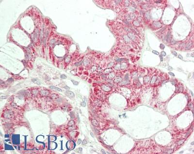 ENTPD5 / CD39L4 Antibody - Human Colon: Formalin-Fixed, Paraffin-Embedded (FFPE)