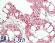 ENTPD5 / CD39L4 Antibody - Human Colon: Formalin-Fixed, Paraffin-Embedded (FFPE)