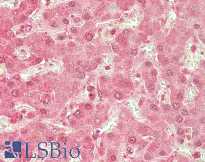 ENTPD5 / CD39L4 Antibody - Human Liver: Formalin-Fixed, Paraffin-Embedded (FFPE)