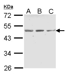 ENTPD5 / CD39L4 Antibody - Sample (30 ug of whole cell lysate). A: A431. B: H1299. C: Hela. 10% SDS PAGE. ENTPD5 antibody diluted at 1:1000. 