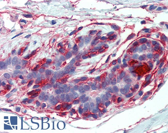 EPB41L2 Antibody - Anti-EPB41L2 antibody IHC of human breast. Immunohistochemistry of formalin-fixed, paraffin-embedded tissue after heat-induced antigen retrieval. Antibody concentration 2.5 ug/ml.