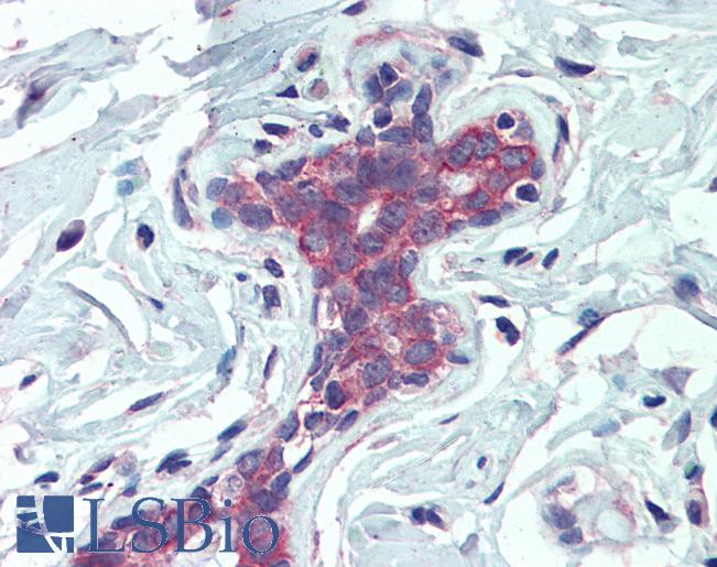 EPB41L2 Antibody - Anti-EPB41L2 antibody IHC of human breast. Immunohistochemistry of formalin-fixed, paraffin-embedded tissue after heat-induced antigen retrieval. Antibody concentration 2.5 ug/ml.