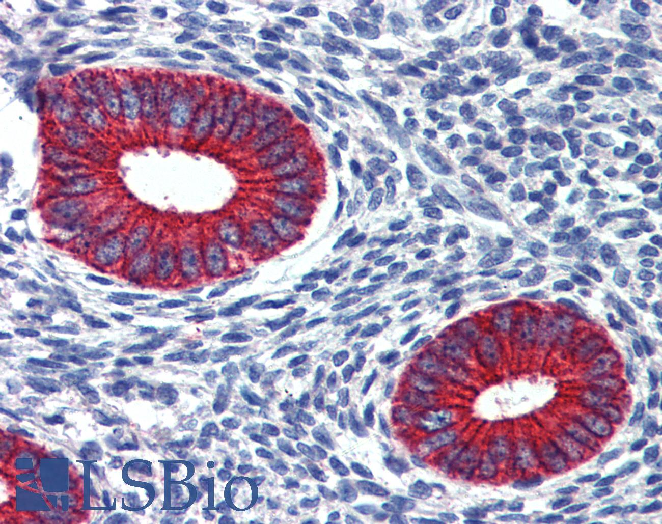 EPB41L2 Antibody - Anti-EPB41L2 antibody IHC of human uterus. Immunohistochemistry of formalin-fixed, paraffin-embedded tissue after heat-induced antigen retrieval. Antibody concentration 2.5 ug/ml.