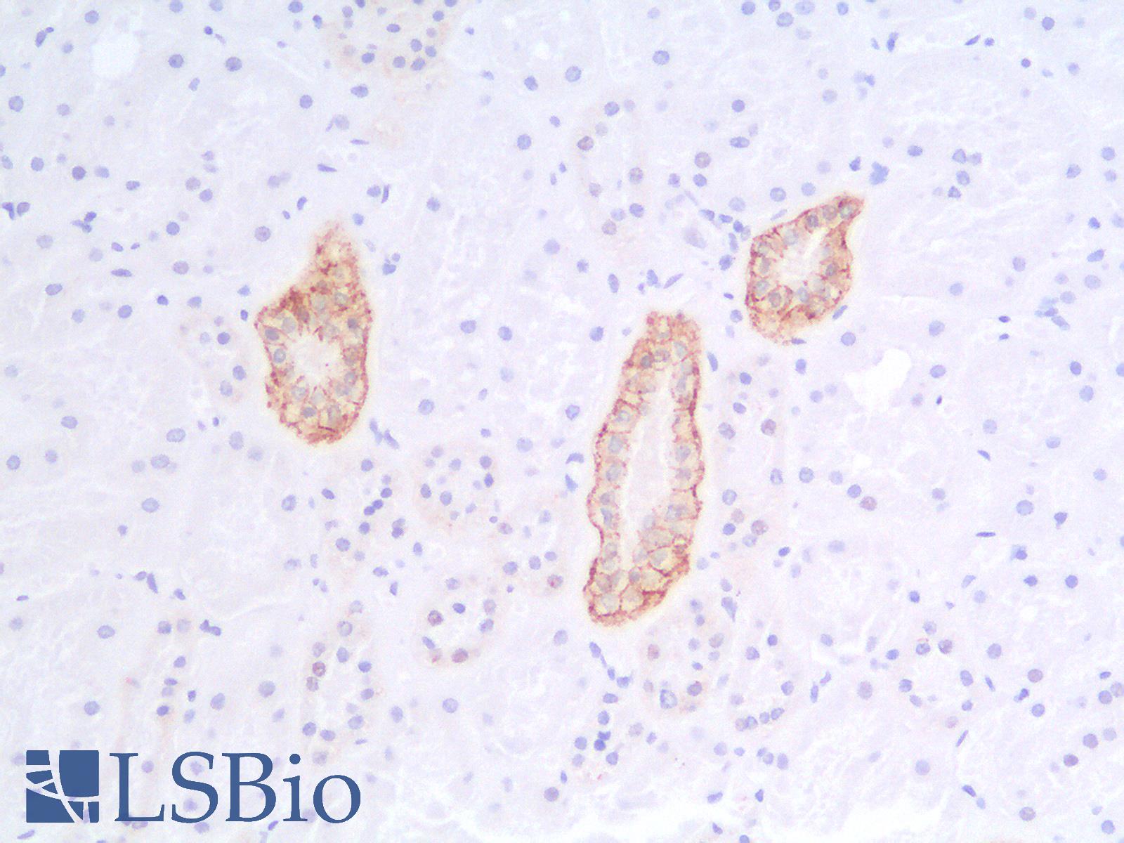 EPCAM Antibody - Human Kidney: Formalin-Fixed, Paraffin-Embedded (FFPE)