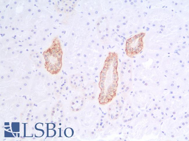 EPCAM Antibody - Human Kidney: Formalin-Fixed, Paraffin-Embedded (FFPE)