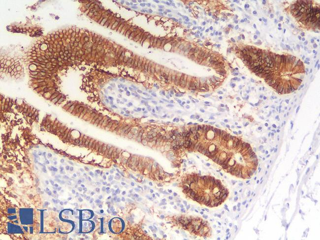 EPCAM Antibody - Human Small Intestine: Formalin-Fixed, Paraffin-Embedded (FFPE)