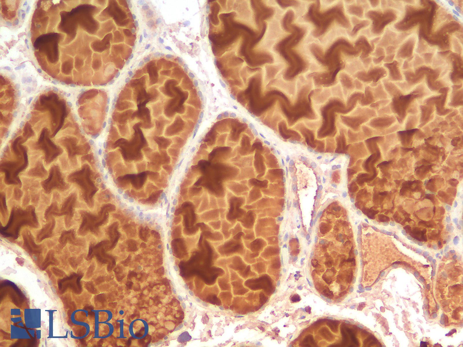 EPCAM Antibody - Human Thyroid: Formalin-Fixed, Paraffin-Embedded (FFPE)