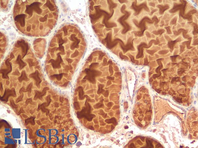 EPCAM Antibody - Human Thyroid: Formalin-Fixed, Paraffin-Embedded (FFPE)