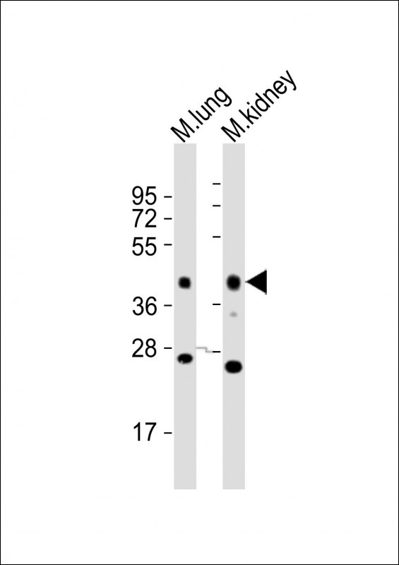 EPCAM Antibody - All lanes : Anti-Epcam Antibody at 1:2000 dilution Lane 1: mouse lung lysates Lane 2: mouse kidney lysates Lysates/proteins at 20 ug per lane. Secondary Goat Anti-Rabbit IgG, (H+L), Peroxidase conjugated at 1/10000 dilution Predicted band size : 35 kDa Blocking/Dilution buffer: 5% NFDM/TBST.