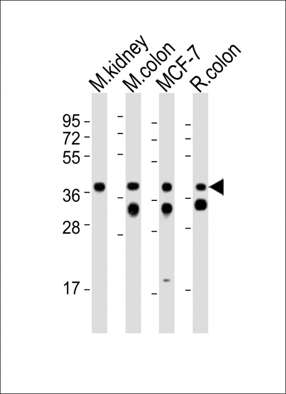 EPCAM Antibody - All lanes : Anti-Epcam Antibody at 1:2000 dilution Lane 1: mouse kidney lysates Lane 2: mouse colon lysates Lane 3: MCF-7 whole cell lysates Lane 4: rat colon lysates Lysates/proteins at 20 ug per lane. Secondary Goat Anti-Rabbit IgG, (H+L), Peroxidase conjugated at 1/10000 dilution Predicted band size : 35 kDa Blocking/Dilution buffer: 5% NFDM/TBST.
