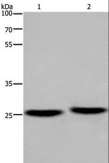 EPDR / EPDR1 Antibody - Western blot analysis of Mouse brain and human fetal muscle tissue, using EPDR1 Polyclonal Antibody at dilution of 1:850.