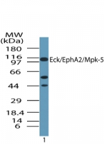 EPHA2 / EPH Receptor A2 Antibody - Western blot of human EphA2 in human ovary lysate in the? absence of immunizing peptide using antibody at 1 ug/ml.