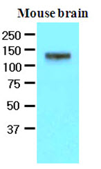 EPHA2 / EPH Receptor A2 Antibody - The extracts of mouse brain (50 ug) were resolved by SDS-PAGE, transferred to NC membrane and probed with anti-human EphA2 (1:500). Proteins were visualized using a goat anti-mouse secondary antibody conjugated to HRP and an ECL detection system.