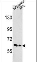 EPHA3 / EPH Receptor A3 Antibody - Western blot of hEPHA3-D130 in NCI-H460,293 cell line lysates (35 ug/lane). EPHA3 (arrow) was detected using the purified antibody.
