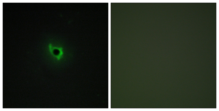 EPHA6 / EPH Receptor A6 Antibody - Immunofluorescence analysis of COS7 cells, using EPHA6 Antibody. The picture on the right is blocked with the synthesized peptide.