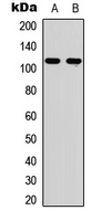 EPHA6 / EPH Receptor A6 Antibody - Western blot analysis of EPHA6 expression in A549 (A); NS-1 (B) whole cell lysates.