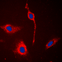 EPHA6 / EPH Receptor A6 Antibody - Immunofluorescent analysis of EPHA6 staining in A549 cells. Formalin-fixed cells were permeabilized with 0.1% Triton X-100 in TBS for 5-10 minutes and blocked with 3% BSA-PBS for 30 minutes at room temperature. Cells were probed with the primary antibody in 3% BSA-PBS and incubated overnight at 4 deg C in a humidified chamber. Cells were washed with PBST and incubated with a DyLight 594-conjugated secondary antibody (red) in PBS at room temperature in the dark. DAPI was used to stain the cell nuclei (blue).