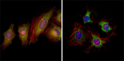 EPHB2 / EPH Receptor B2 Antibody - Immunofluorescence of HeLa (left) and HepG2 (right) cells using EphB2 mouse monoclonal antibody (green). Red: Actin filaments have been labeled with DY-554 phalloidin. Blue: DRAQ5 fluorescent DNA dye.