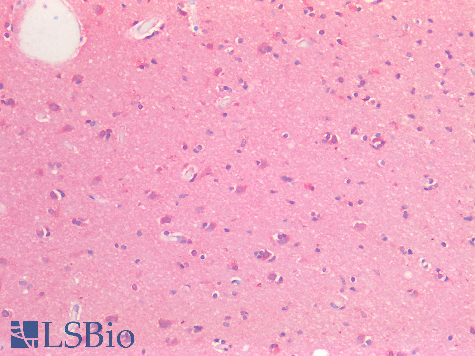 EPHB2 / EPH Receptor B2 Antibody - Human Brain, Cortex: Formalin-Fixed, Paraffin-Embedded (FFPE)