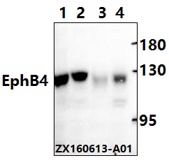 EPHB4 / EPH Receptor B4 Antibody - Western blot analysis of Anti-EPHB4 pAb at 1:500 dillution. Lane1: Hcc827 whole cell lysate. Lane2: LO2 whole cell lysate. Lane3: The Kidney tissue lysate of Mouse. Lane4: The Kidney tissue lysate of Rat.