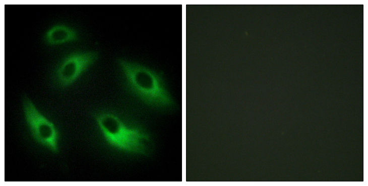EPHB6 / EPH Receptor B6 Antibody - Immunofluorescence analysis of HeLa cells, using EPHB6 Antibody. The picture on the right is blocked with the synthesized peptide.