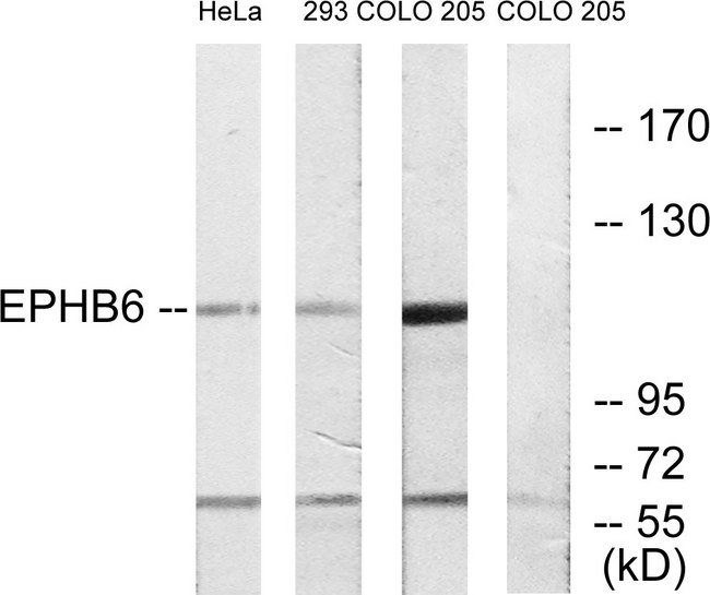 EPHB6 / EPH Receptor B6 Antibody - Western blot analysis of lysates from COLO, 293, and HeLa cells, using EPHB6 Antibody. The lane on the right is blocked with the synthesized peptide.