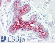 EPHB6 / EPH Receptor B6 Antibody - Anti-EPHB6 antibody IHC of human breast. Immunohistochemistry of formalin-fixed, paraffin-embedded tissue after heat-induced antigen retrieval. Antibody dilution 1:50.