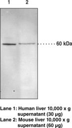 EPHX2 / Epoxide Hydrolase 2 Antibody - Western blot of SEH / EPHX2 antibody.