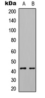 EPHX4 / Epoxide Hydrolase 4 Antibody - Western blot analysis of ABHD7 expression in HEK293T (A); HepG2 (B) whole cell lysates.