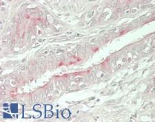 EPHX4 / Epoxide Hydrolase 4 Antibody - Human Lung, Respiratory Epithelium: Formalin-Fixed, Paraffin-Embedded (FFPE)