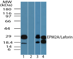 EPM2A / Laforin Antibody - Western blot of EPM2A in human heart lysate in the 1) absence and2) presence of immunizing peptide,3) mouse heart and 4) rat heart lysate using EPM2A / Laforin Antibody at 0.25 ug/ml, 0.5 ug/ml and 0.5 ug/ml, respectively.
