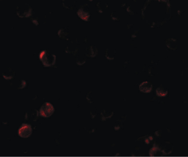 EPM2A / Laforin Antibody - Immunofluorescence of EPM2A in SW480 cells with EPM2A antibody at 5 ug/ml.
