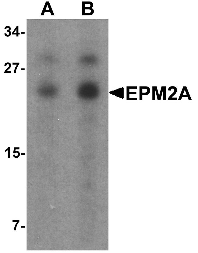 EPM2A / Laforin Antibody - Western blot analysis of SW480 in SW480 cell lysate with EPM2A antibody at (A) 1 and (B) 2 ug/ml.