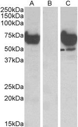 EPM2AIP1 Antibody - HEK293 lysate (10ug protein in RIPA buffer) overexpressing Human EPM2AIP1 with DYKDDDDK tag probed with (1ug/ml) in Lane A and probed with anti-DYKDDDDK Tag (1/1000) in lane C. Mock-transfected HEK293 probed (1mg/ml) in Lane B. Primar