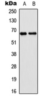 EPN2 Antibody - Western blot analysis of EPN2 expression in HEK293T (A); NIH3T3 (B) whole cell lysates.