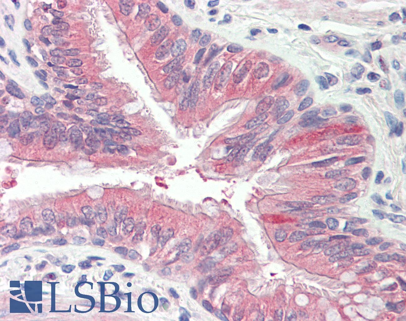 EPS8L2 Antibody - Anti-EPS8L2 antibody IHC staining of human lung, respiratory epithelium. Immunohistochemistry of formalin-fixed, paraffin-embedded tissue after heat-induced antigen retrieval.
