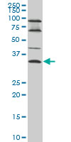 EPSTI1 Antibody - EPSTI1 monoclonal antibody, clone 2A8 Western blot of EPSTI1 expression in A-431.