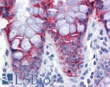 EPSTI1 Antibody - Anti-EPSTI1 antibody IHC of human colon. Immunohistochemistry of formalin-fixed, paraffin-embedded tissue after heat-induced antigen retrieval. Antibody concentration 5 ug/ml.