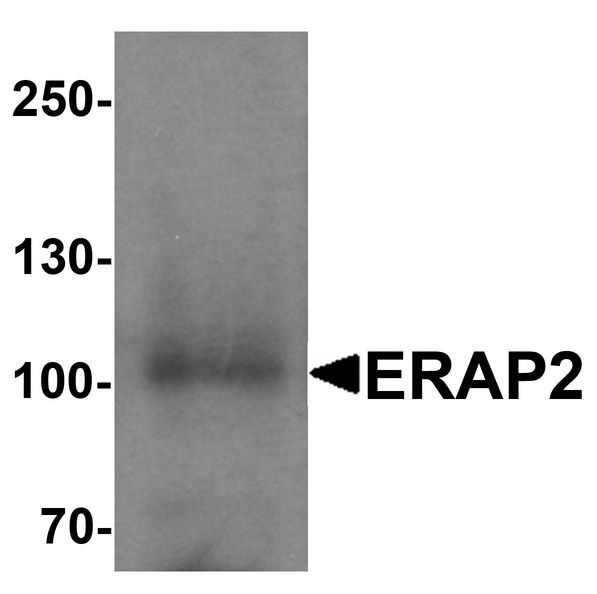 ERAP2 / Aminopeptidase Antibody - Western blot analysis of ERAP2 in rat small intestine tissue lysate with ERAP2 antibody at 1 ug/ml.