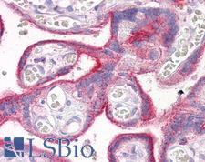 ERBB2 / HER2 Antibody - Anti-ERBB2 / HER2 antibody IHC of human placenta. Immunohistochemistry of formalin-fixed, paraffin-embedded tissue after heat-induced antigen retrieval. Antibody concentration 10 ug/ml.