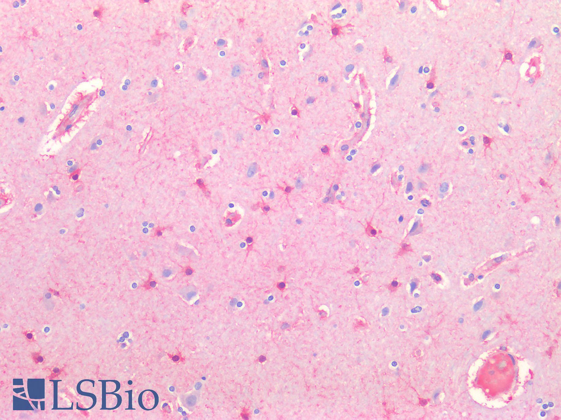 ERBB3 / HER3 Antibody - Human Brain, Cortex: Formalin-Fixed, Paraffin-Embedded (FFPE)