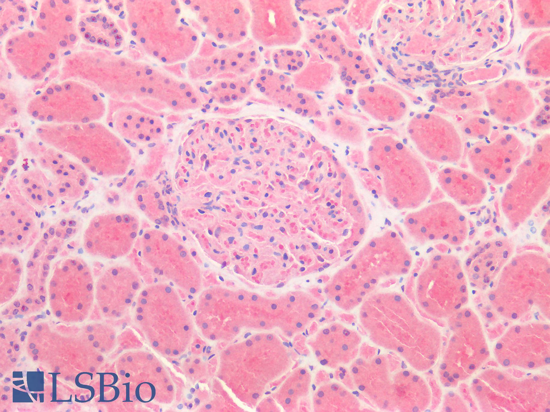 ERBB3 / HER3 Antibody - Human Kidney: Formalin-Fixed, Paraffin-Embedded (FFPE)